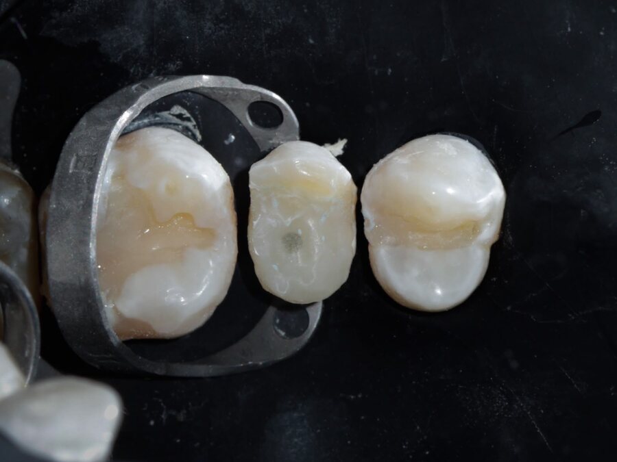 Endodoncia